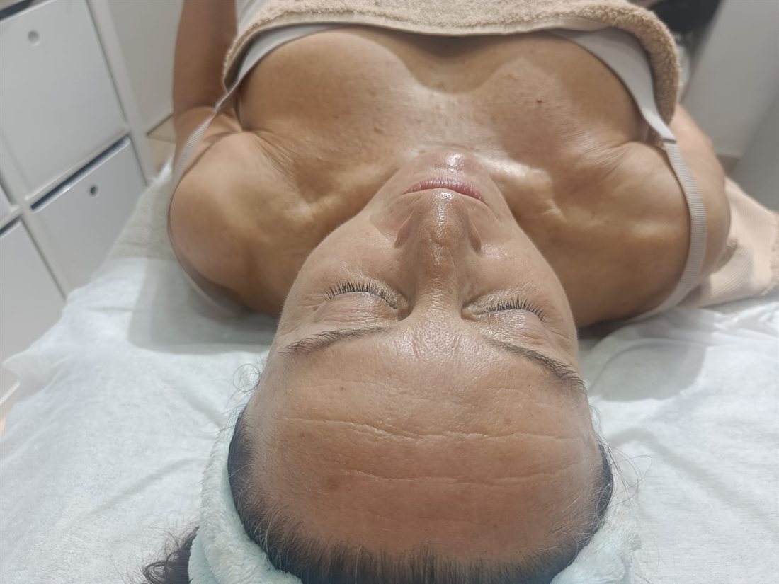 Resultado de tratamiento facial con luminosidad